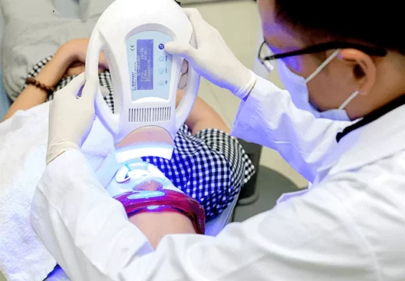 tẩy trắng răng laser whitening