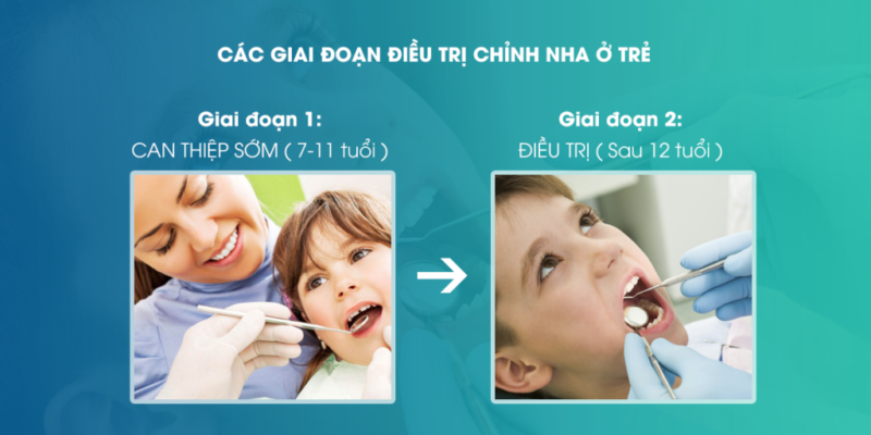 Các giai đoạn điều trị chỉnh nha ở trẻ em